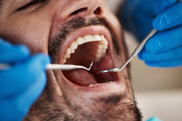 Best Emergency Dentist for Knocked-Out Tooth in Gra Forks Af, ND